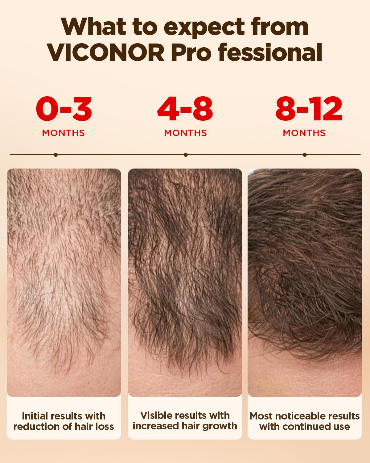 Hair Growth System: Red Light Therapy for Hair Growth Laser Cap